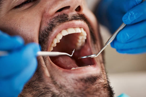 Best Emergency Dental Care for Broken or Chipped Teeth in Three Lakes, WA